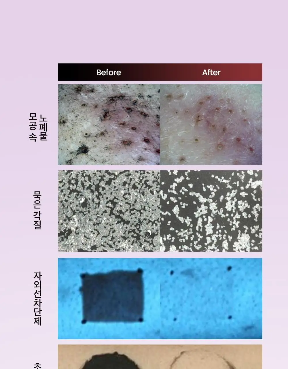 [결광케어/팥팩폼]비플레인 팥 콜라겐 팩투폼 클렌저 100ml 기획 (+5ml*4ea) 상세페이지 20